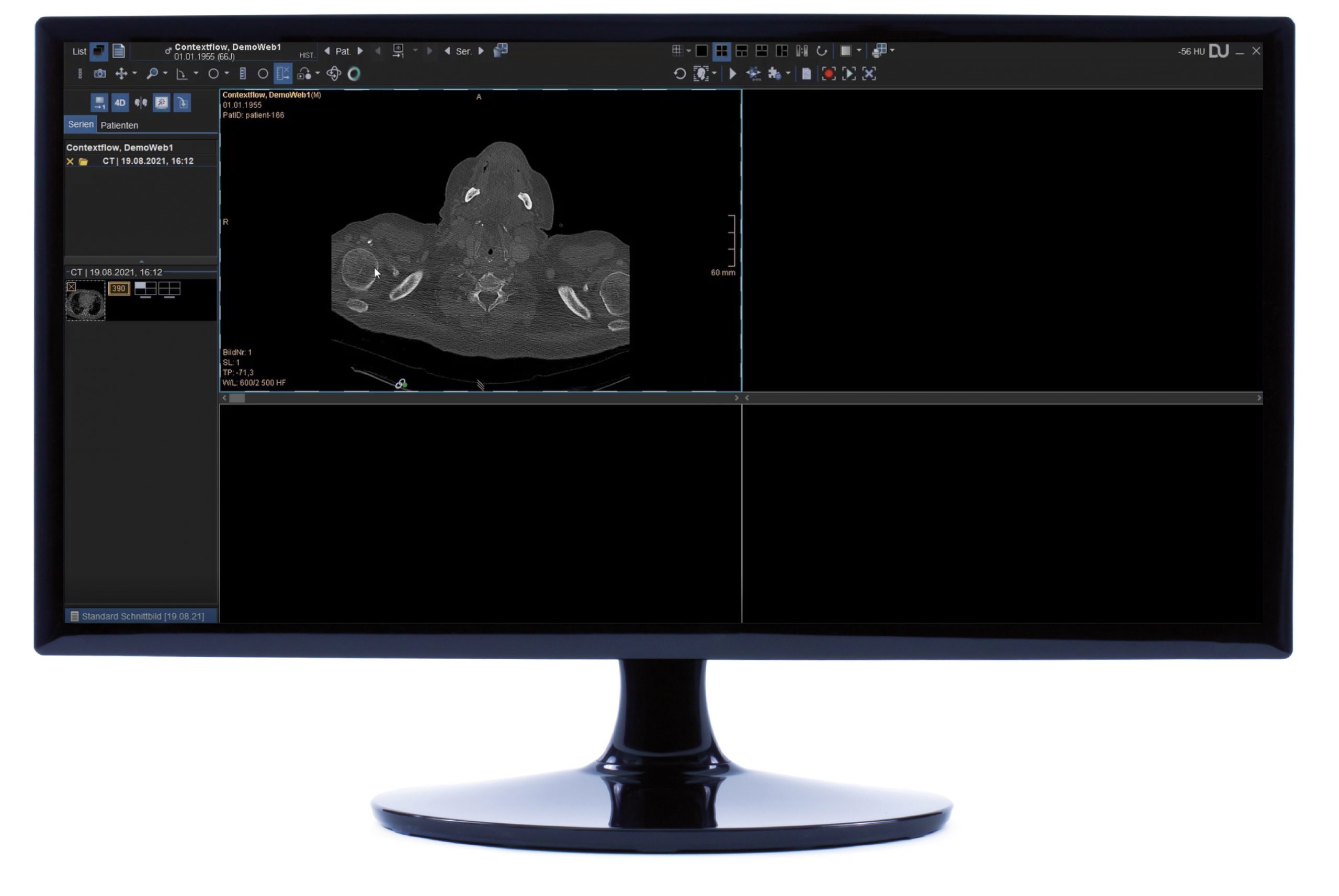 Dedalus HealthCare integrates contextflow SEARCH Lung CT into DeepUnity ...