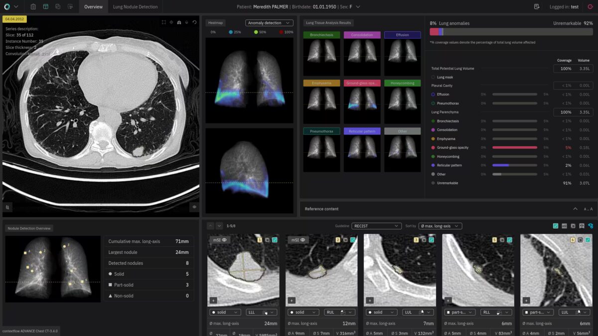 Screenshot CFA Chest CT 3.4.0